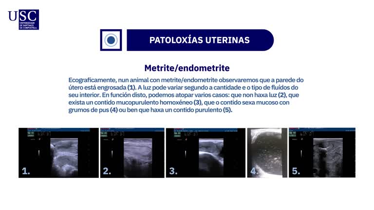 Video - Exploración ecográfica do aparello xenital da vaca - Diagnóstico de patoloxías ováricas e uterinas